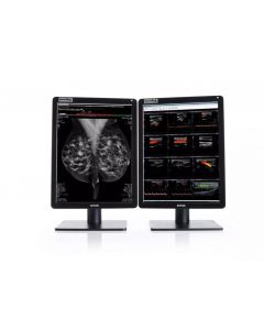 Barco K9602918 (mdnc-6121 2h2f nc excl dc) 21.3in 2100x2800 mammography, 1000cd/m2 1400:1, dp/dvi-d
